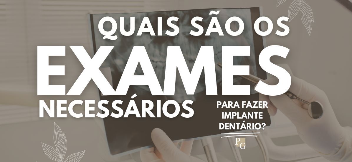 Quais são os exames necessário para fazer implante dental